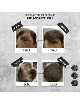 TRU Hairline Powder Haaransatz-Farbpuder Für Lichtes Haar, 4g Wetterfest