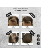 TRU Hairline Powder Haaransatz-Farbpuder Für Lichtes Haar, 4g Wetterfest